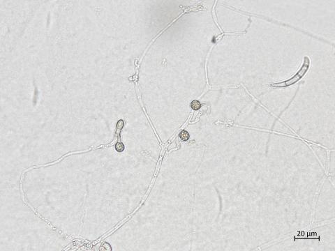 Neocosmospora_solani_4