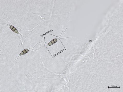 Neopestalotiopsis_sp_3