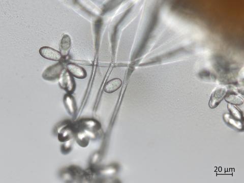 Orbilia_blumenaviensis_1