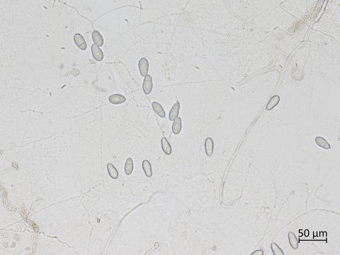 Orbilia_blumenaviensis_2