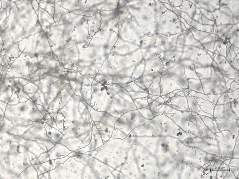 Phytophthora_cactorum_1