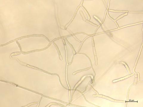 Rhizoctonia_solani_7