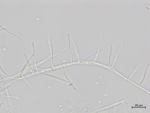 Sarocladium_strictum_1