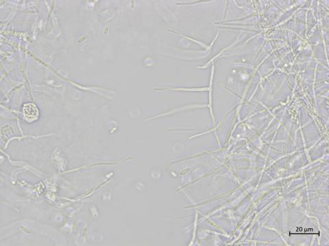 Sarocladium_strictum_2