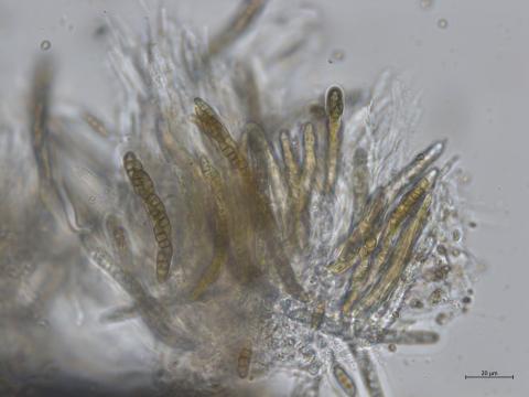 Paraconiothyrium coniothyrium