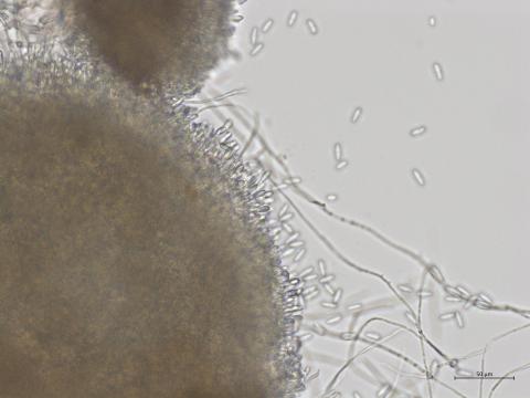 Colletotrichum_fioriniae_3
