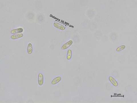 Colletotrichum_petchii_2