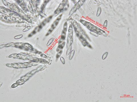 Colletotrichum_salicis_1