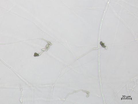 Colletotrichum_coccodes_15