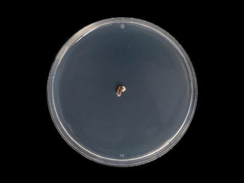 Diplocarpon_fragariae_4