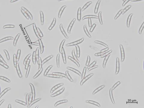 Fusarium_sambucinum_6