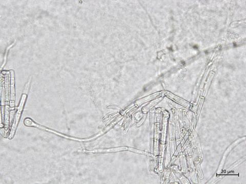 Calonectria_sp_2