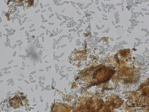 Colletotrichum_sp_6