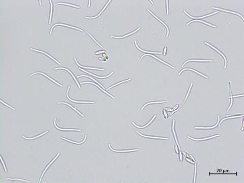 Diaporthe_sp_4