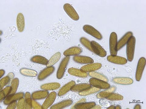 Diplodia_sapinea_2
