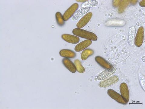 Diplodia_sp_1