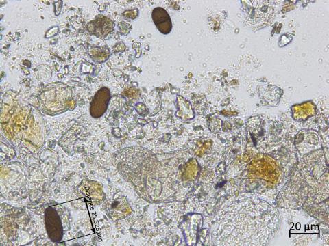 Diplodia_sp_3