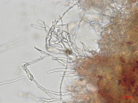 Elsinoe_ampelina_8