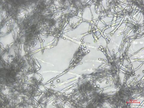 Penicillium_expansum_1