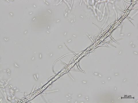 Phaeoacremonium_fraxinopennsylvanicum_2