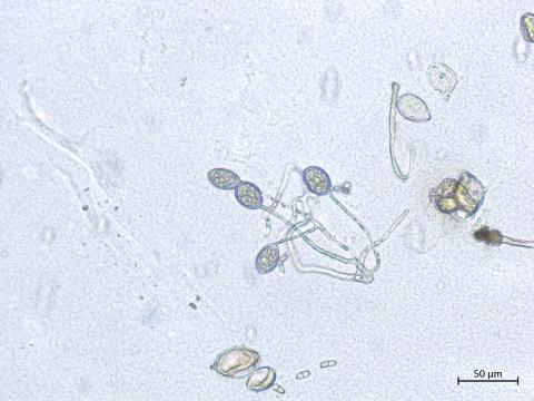Phytophthora_infestans_4